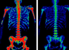 UMIH - United Medical Imaging Healthcare | Outpatient Radiology ... — Radiology/Imaging clinic in Anaheim, CA — photo 6