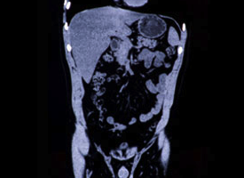 PET/CT